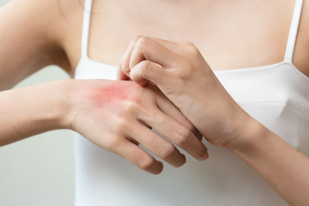 Pelle sensibile: dalle caratteristiche ai detergenti ideali